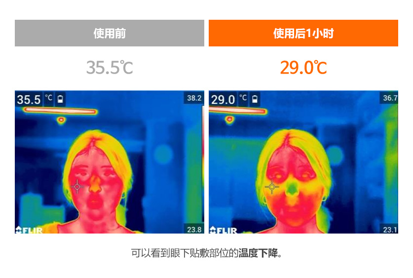 패치 붙이기 전:35.5도 부착 후 1시간:29.0도